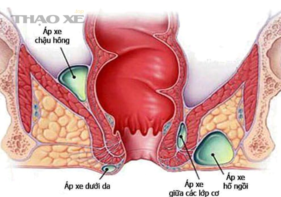 Quy trình 3 bước nào giúp kiểm tra nhanh vị trí rò trước khi vào gara?