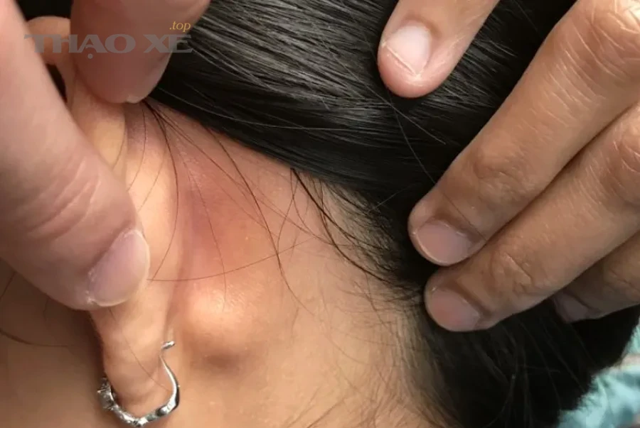 Những nguyên nhân nào khiến xe đề nóng bị ì và lên ga không bốc?