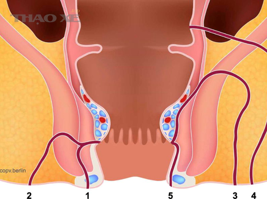 Bình nước làm mát và dấu hiệu rò rỉ nước làm mát thường gặp