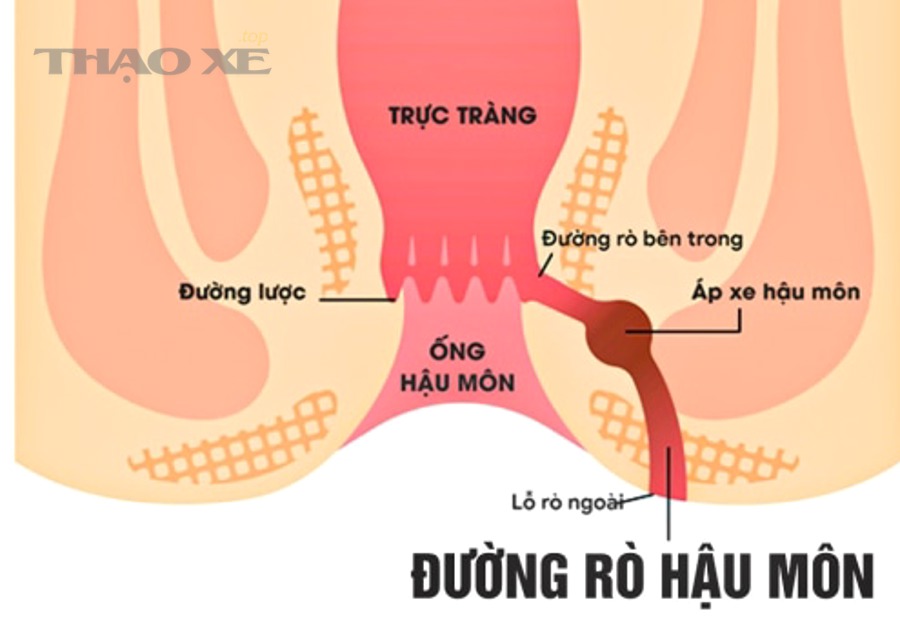 Vì sao đã kiểm tra vẫn “không thấy rò” nhưng xe vẫn hao nước/hao dầu?