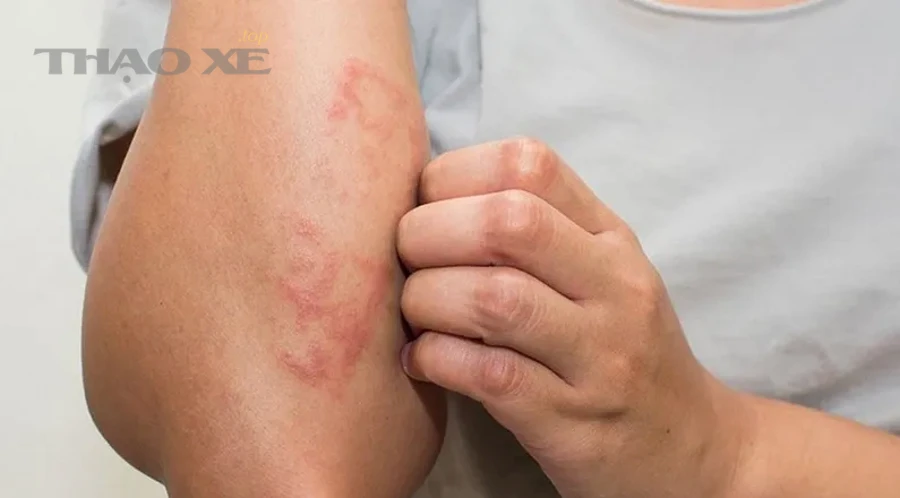 So sánh các nguyên nhân “thường gặp” và “nghiêm trọng” để ưu tiên sửa trước?