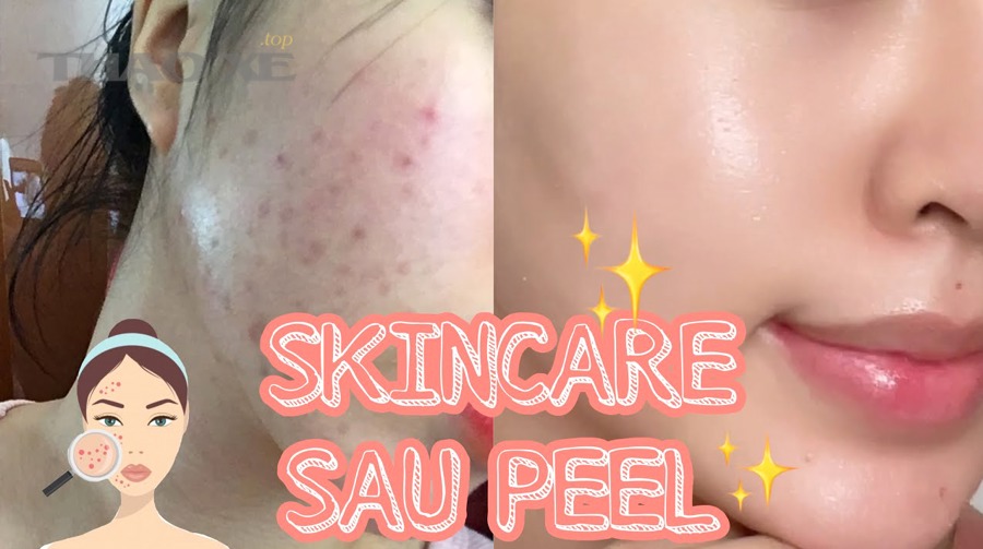 Những tình huống chuyên sâu nào khiến quy trình chăm sóc sơn sau phục hồi phải điều chỉnh?