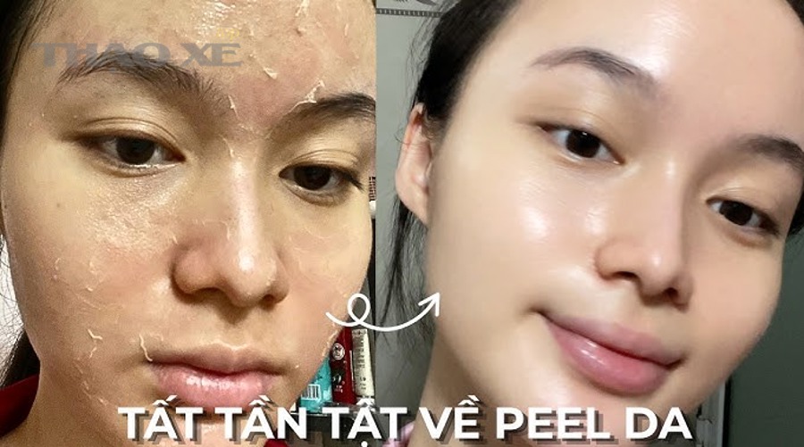 Quy trình rửa xe 2 xô giúp hạn chế xước xoáy sau phục hồi sơn