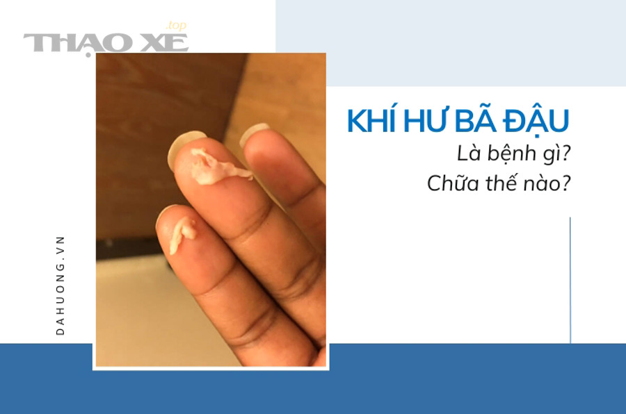 Kỹ thuật viên kiểm tra dầu động cơ để xử lý tình huống rò dầu tạm thời