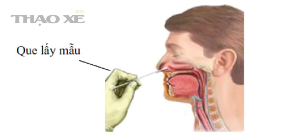 Xử lý kết quả test nhanh tại nhà theo từng kịch bản dương tính âm tính và không hợp lệ