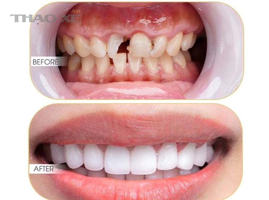 Kiểm tra hông lốp ô tô trước đăng kiểm
