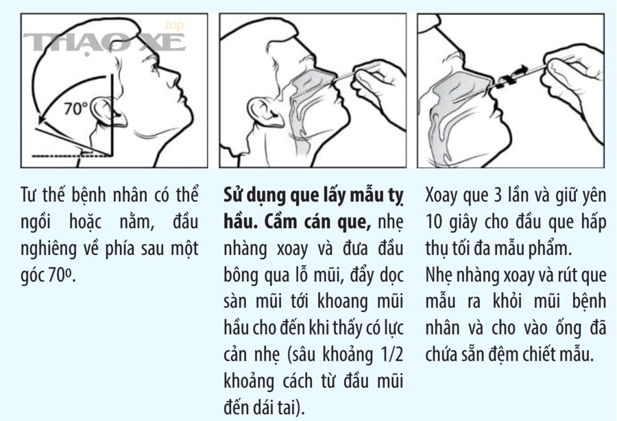 Vì sao cùng một người nhưng test nhanh có thể lúc dương tính, lúc âm tính?