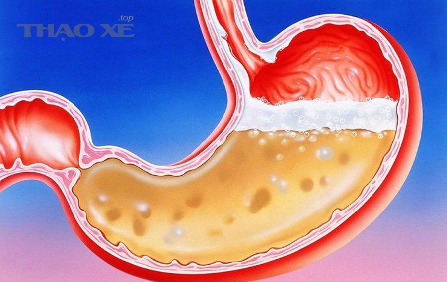 Những hiểu lầm thường gặp khi cân chỉnh thước lái (và cách tránh “tiền mất tật mang”)