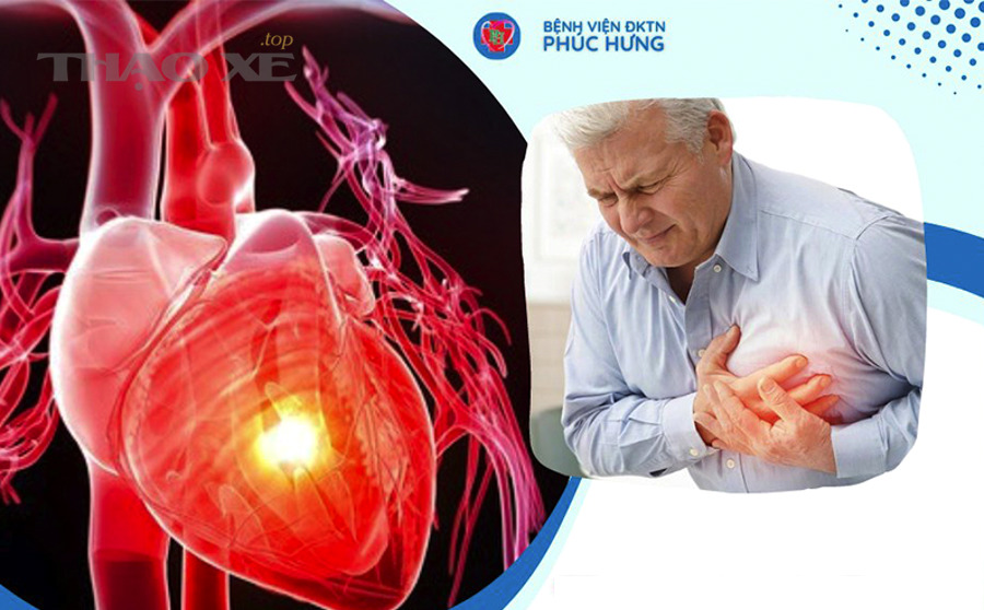 Khi nào nên đi cân chỉnh thước lái: theo dấu hiệu, theo tình huống, hay theo định kỳ?
