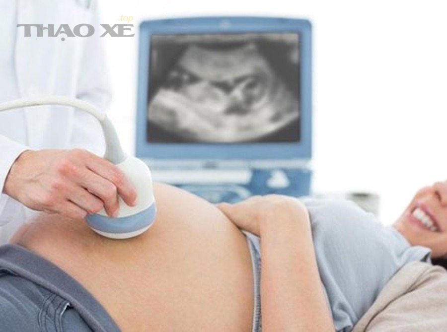 Máy cân chỉnh thước lái và thiết bị đo góc đặt bánh xe tại gara