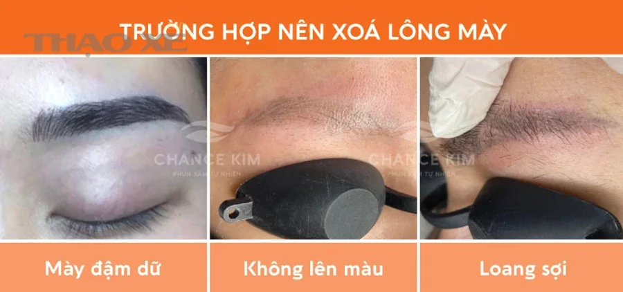 Đèn Check Engine trên bảng đồng hồ ô tô