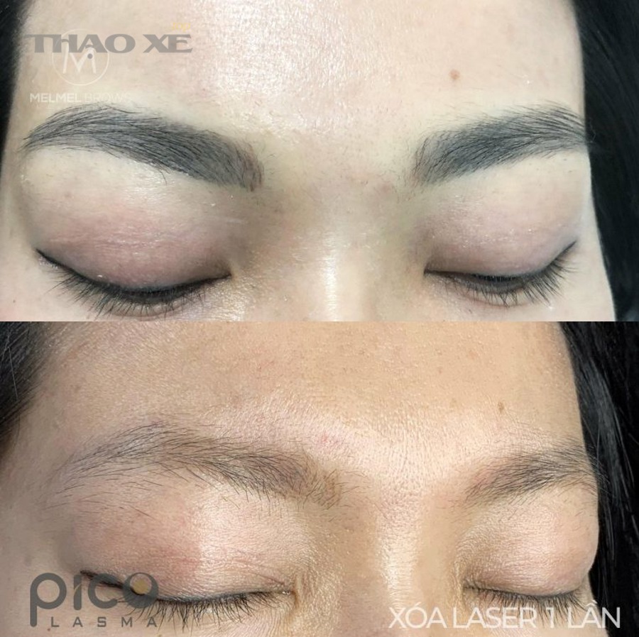 Quy trình chuẩn cho chủ xe mới: Đọc lỗi → Sửa nguyên nhân → Xóa lỗi → Kiểm chứng