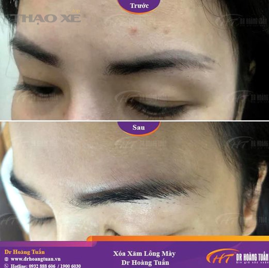 Xóa lỗi trước kiểm định có lợi hay hại cho kết quả?