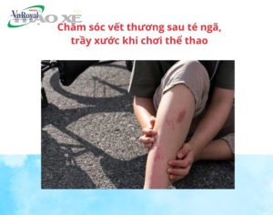 cham soc vet thuong sau te nga tray xuoc khi choi the thao cho nguoi lon va tre 1 1
