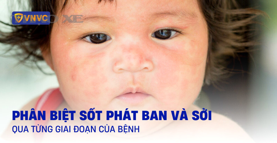 Động cơ ô tô là nguồn tạo công suất nên khi yếu máy xe sẽ phản ứng ga chậm và tăng tốc kém