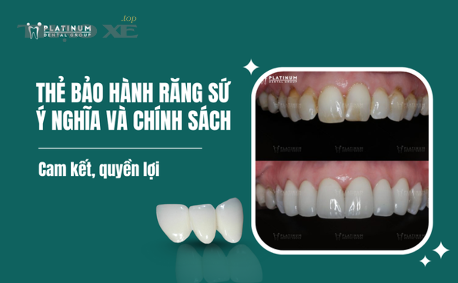 Dấu hiệu nào cho thấy ắc quy xe ít đi đang cần sạc bảo dưỡng?